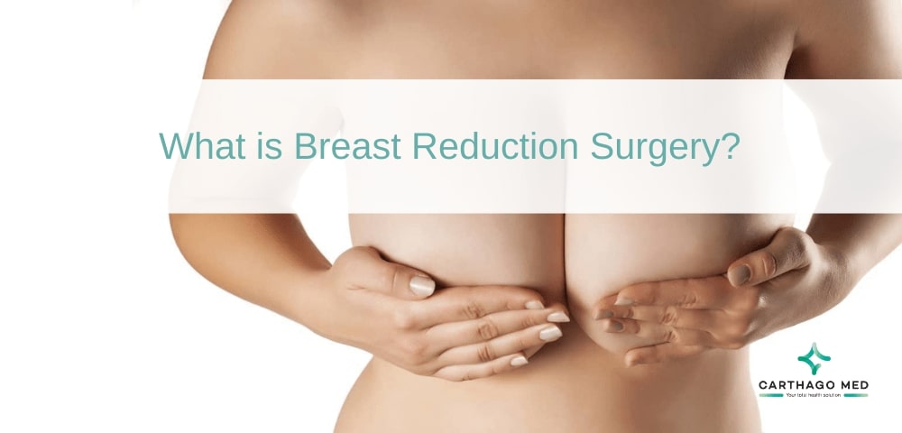 Breast reduction surgery