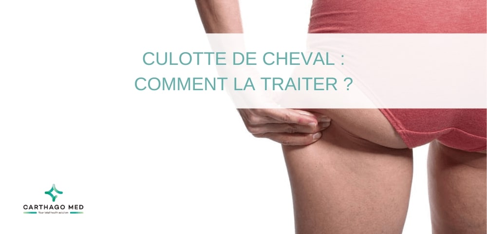 Culotte de cheval : comment la traiter