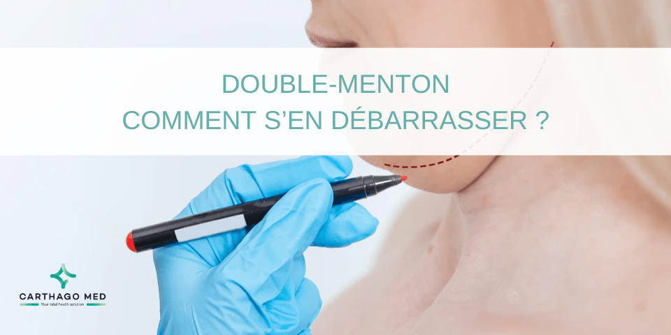 Double-menton : comment se débarrasser