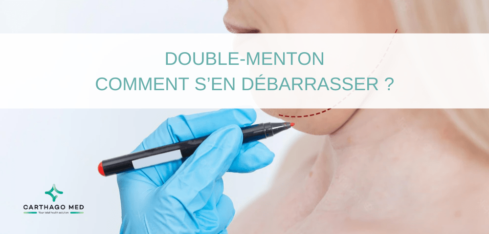 Double-menton : comment se débarrasser