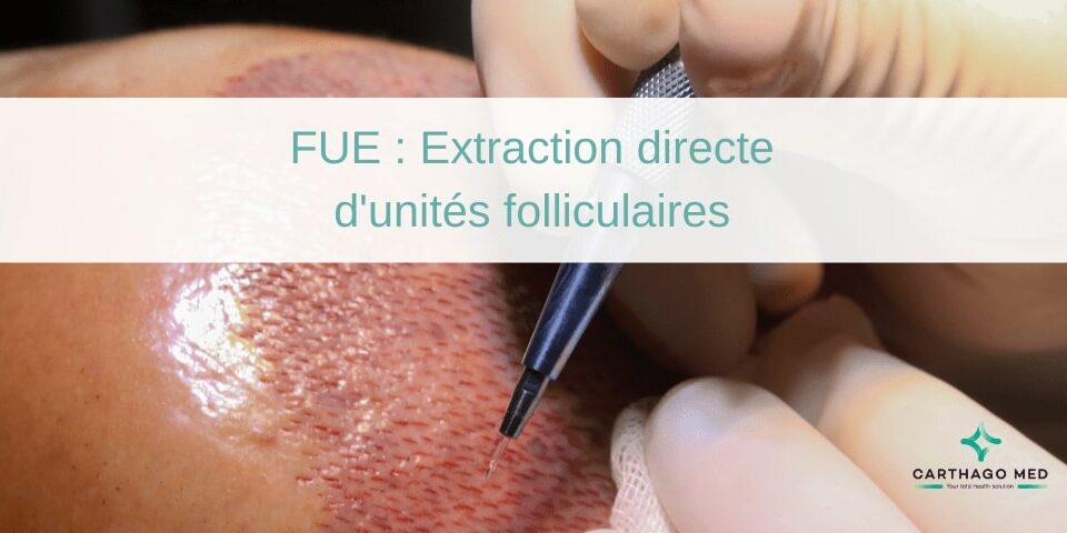 FUE Extraction directe d'unités folliculaires