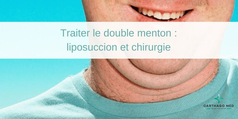 Traiter le double menton