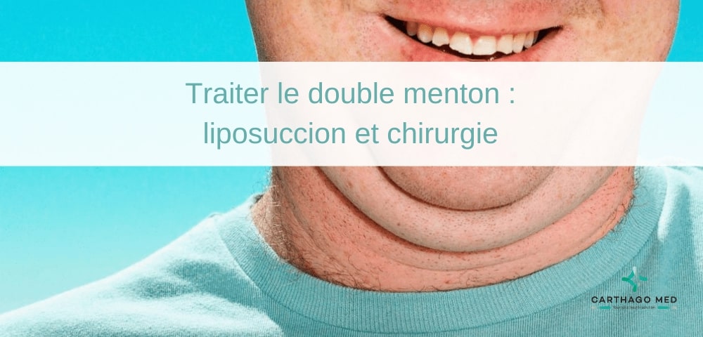 Traiter le double menton