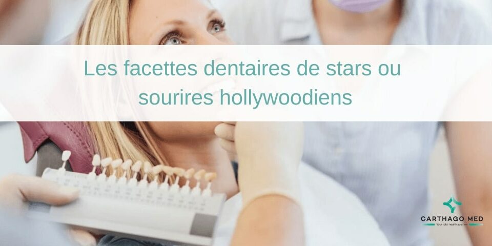 facettes dentaires de stars ou sourires hollywoodiens