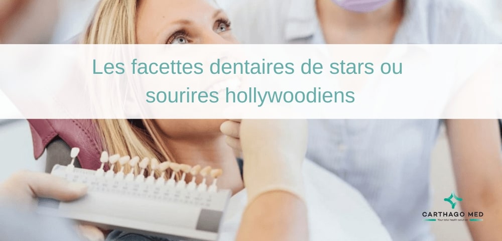 facettes dentaires de stars ou sourires hollywoodiens