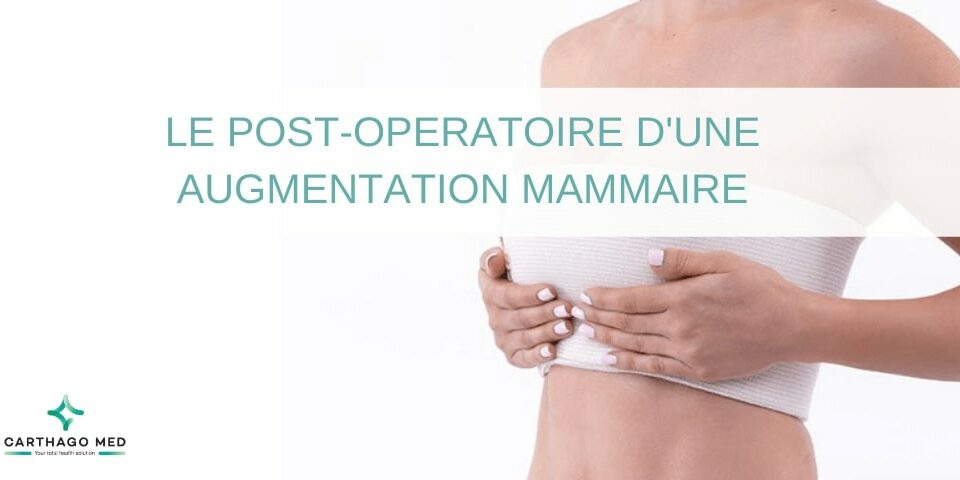 post operatoire augmentation mammaire