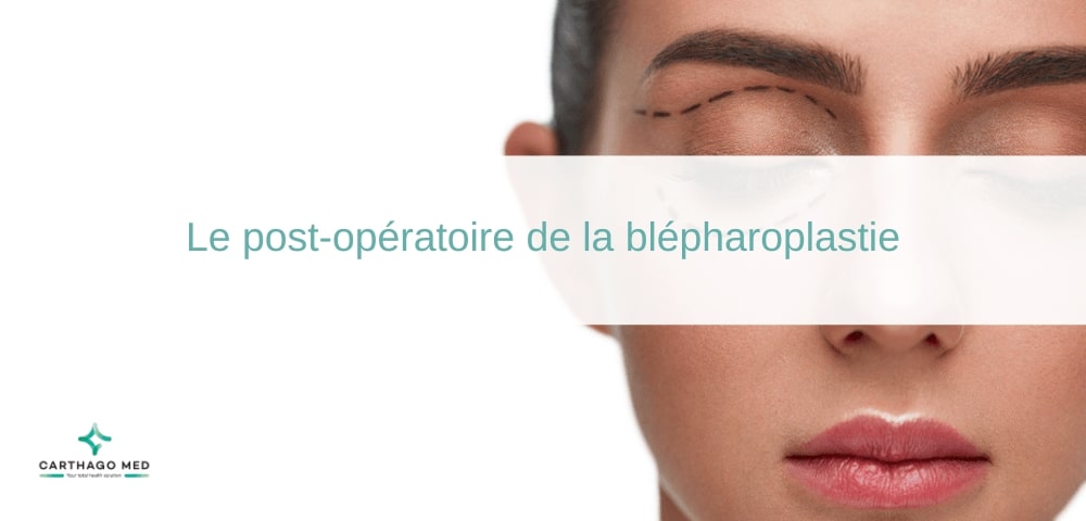 Le post-opératoire de la blépharoplastie