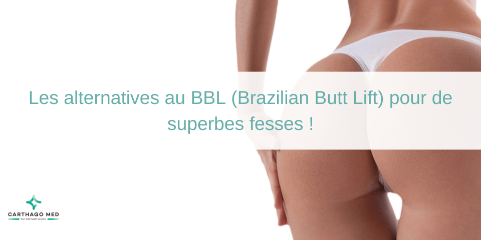 alternatives au BBL