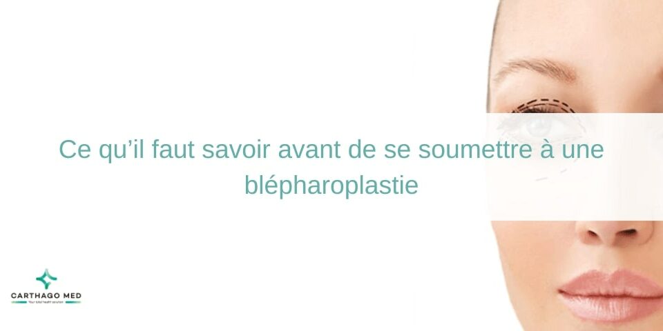 soumettre à une blépharoplastie