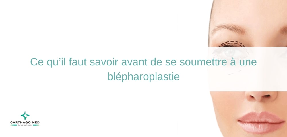 soumettre à une blépharoplastie