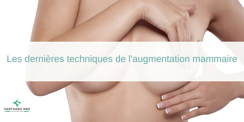 Dernières techniques de l'augmentation mammaire