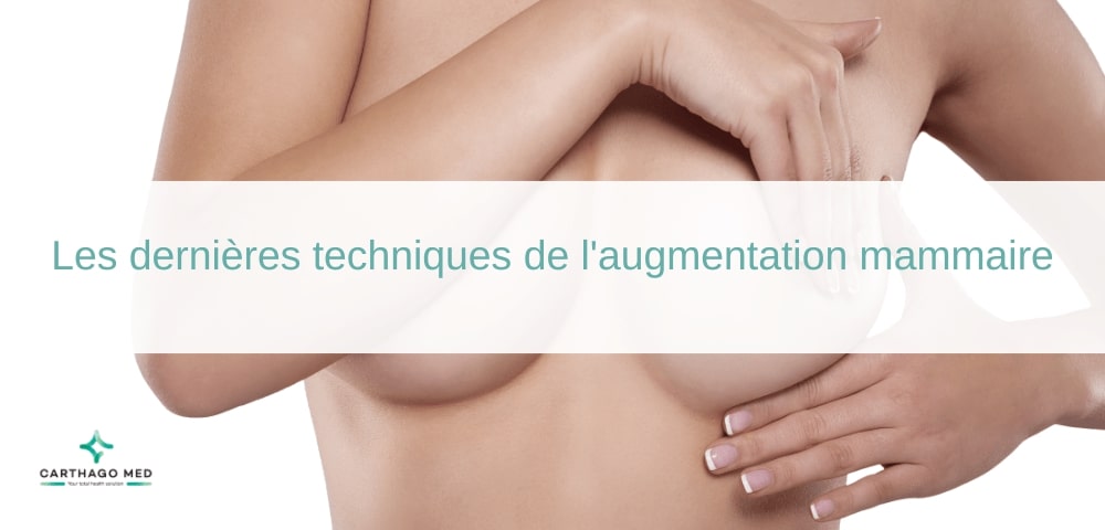 Dernières techniques de l'augmentation mammaire