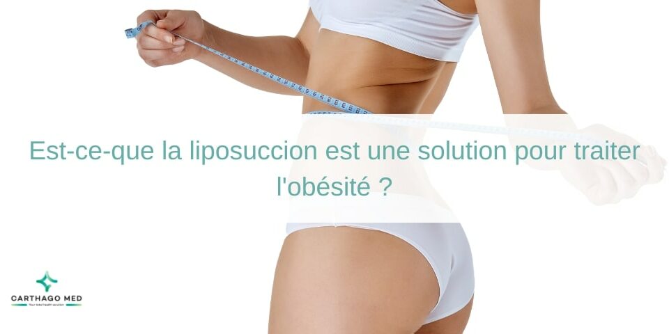 Est ce que la liposuccion est une solution pour traiter l'obésité