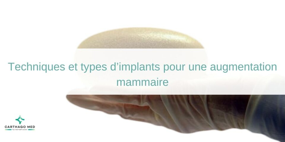 Techniques et types d’implants pour une augmentation mammaire