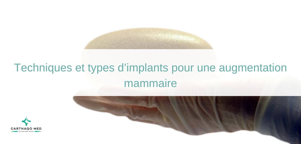 Techniques et types d’implants pour une augmentation mammaire