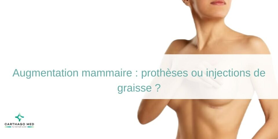 Augmentation mammaire prothèses ou injections de graisse