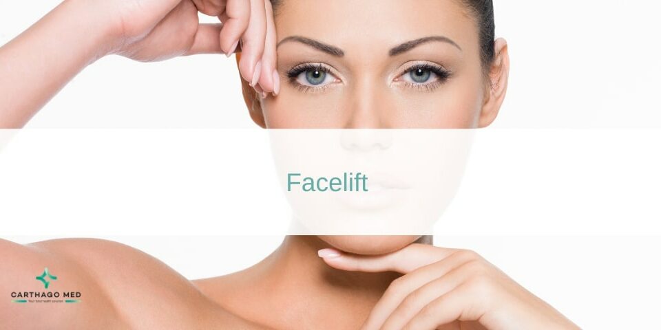 Facelift