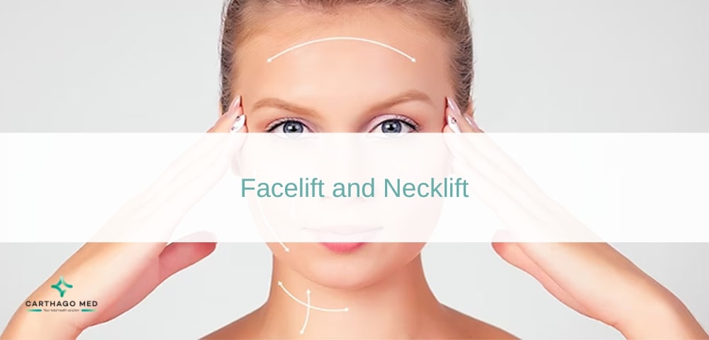 Facelift and Necklift