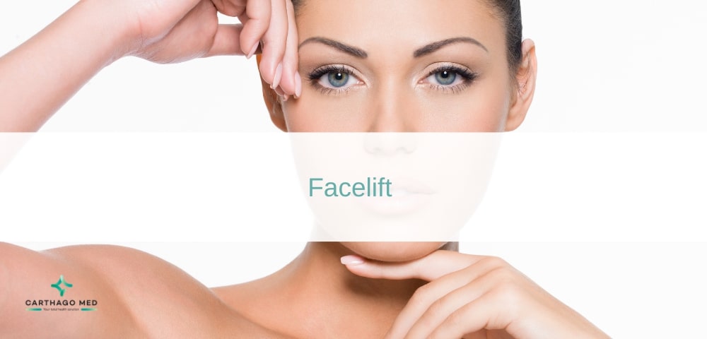 Facelift