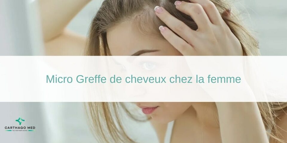 Micro Greffe de cheveux chez la femme