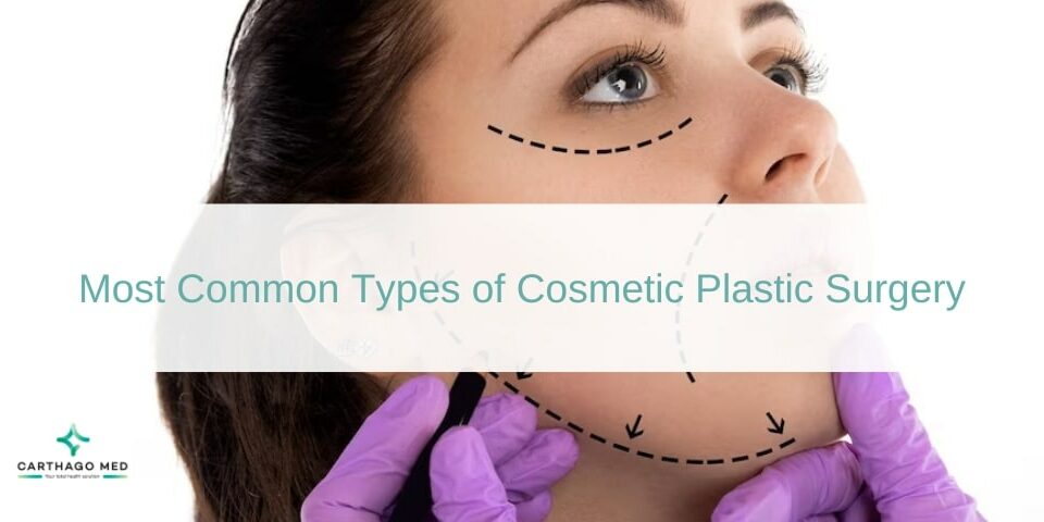 Most Common Types of Cosmetic Plastic Surgery