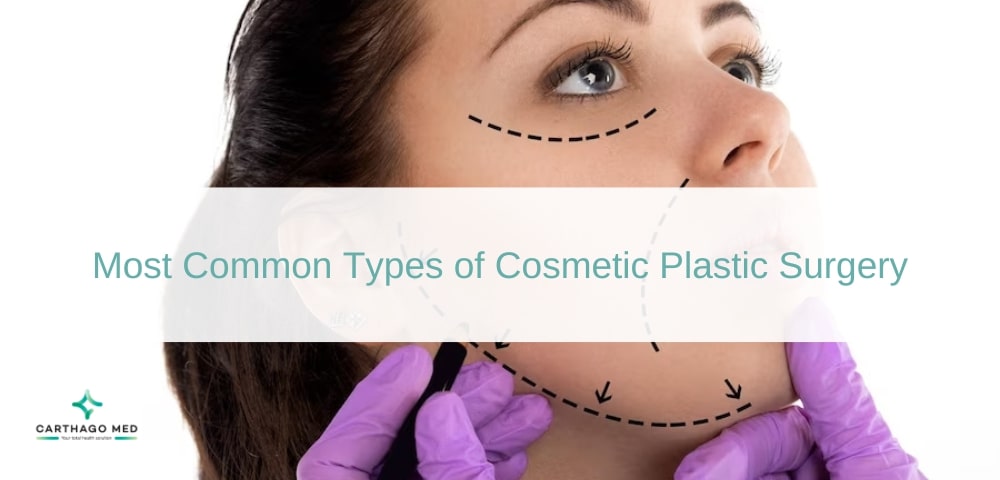 Most Common Types of Cosmetic Plastic Surgery