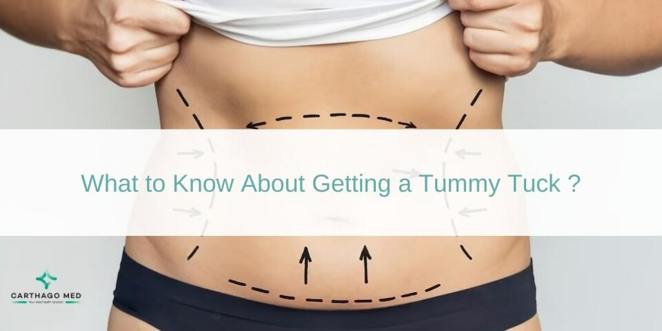 Tummy Tuck