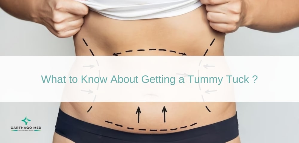 Tummy Tuck