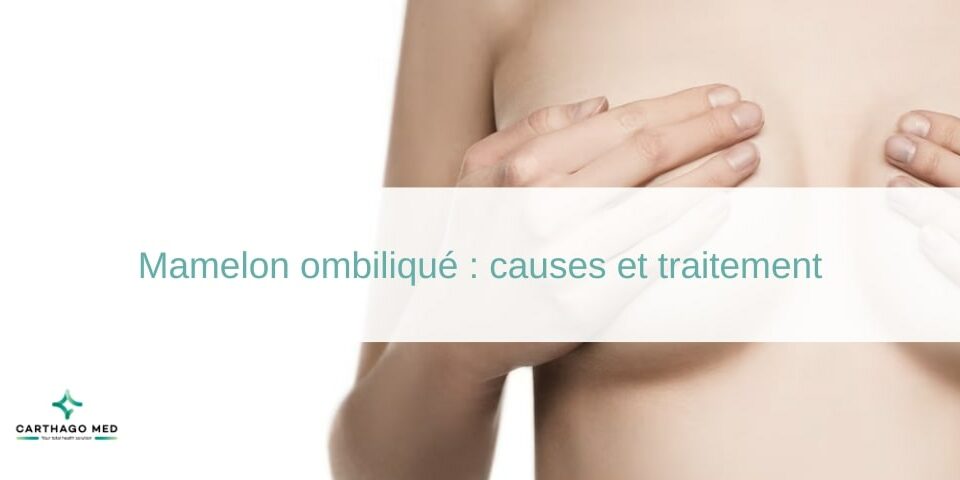 Mamelon ombiliqué : causes et traitement