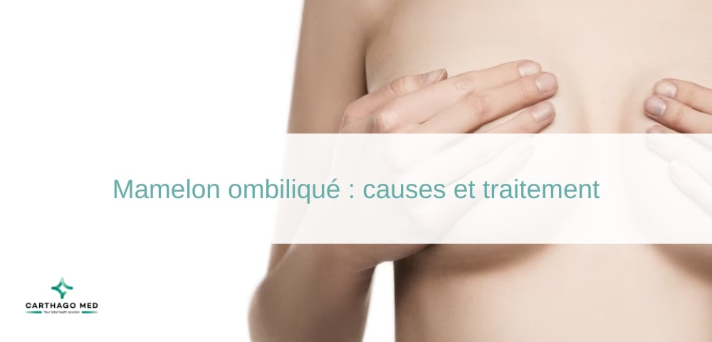 Mamelon ombiliqué : causes et traitement