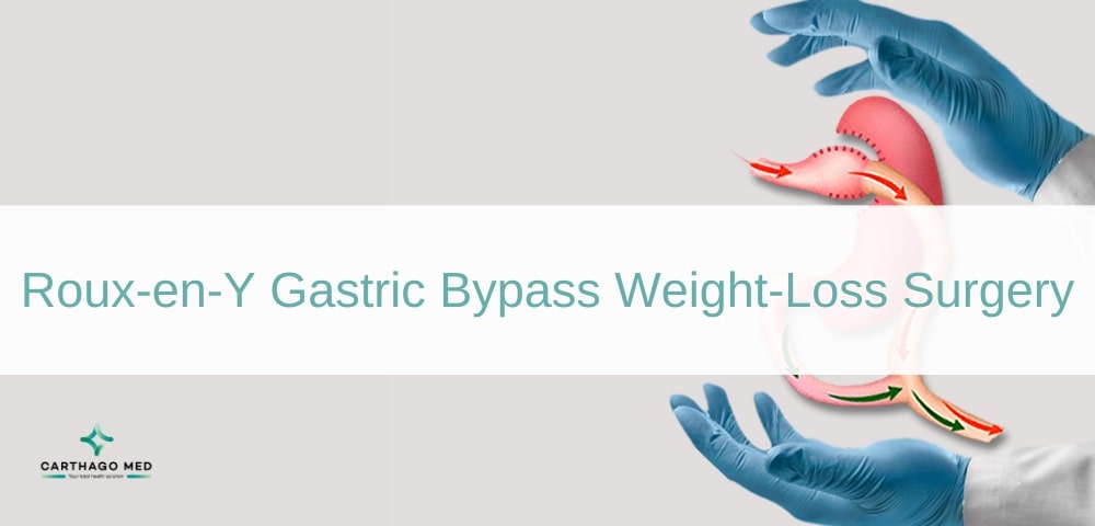 Gastric Bypass