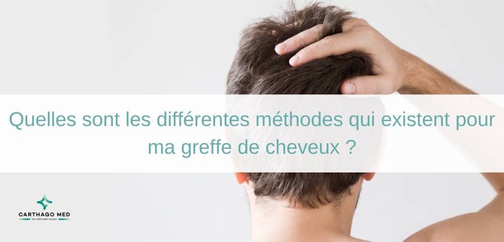 La greffe de cheveux