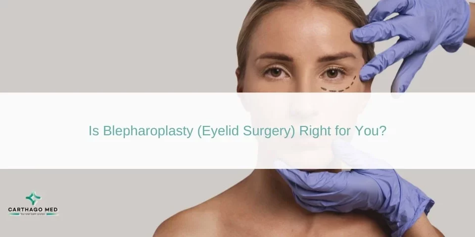 Blepharoplasty