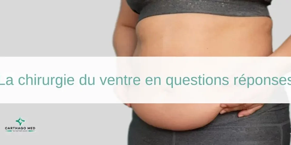 la chirurgie du ventre