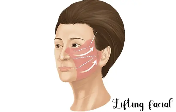 Lifting facial