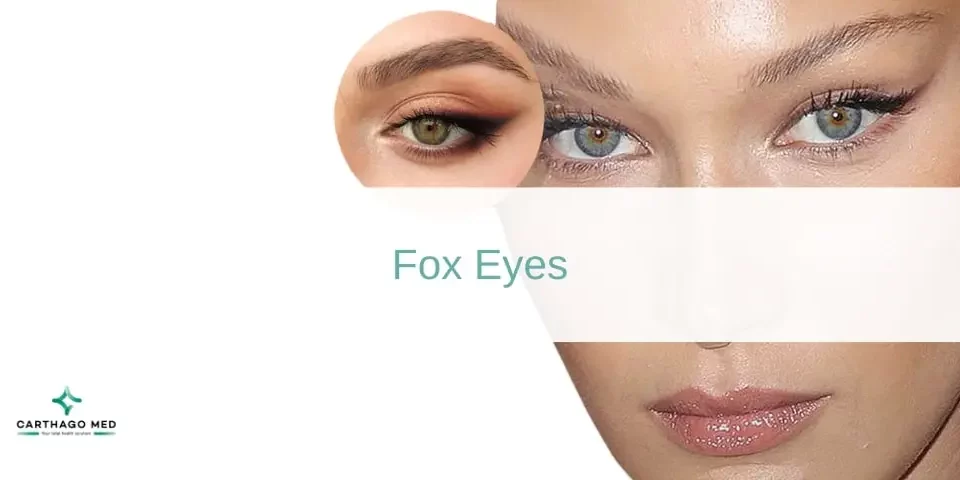 Fox Eyes