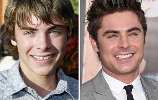 Zac Efron 